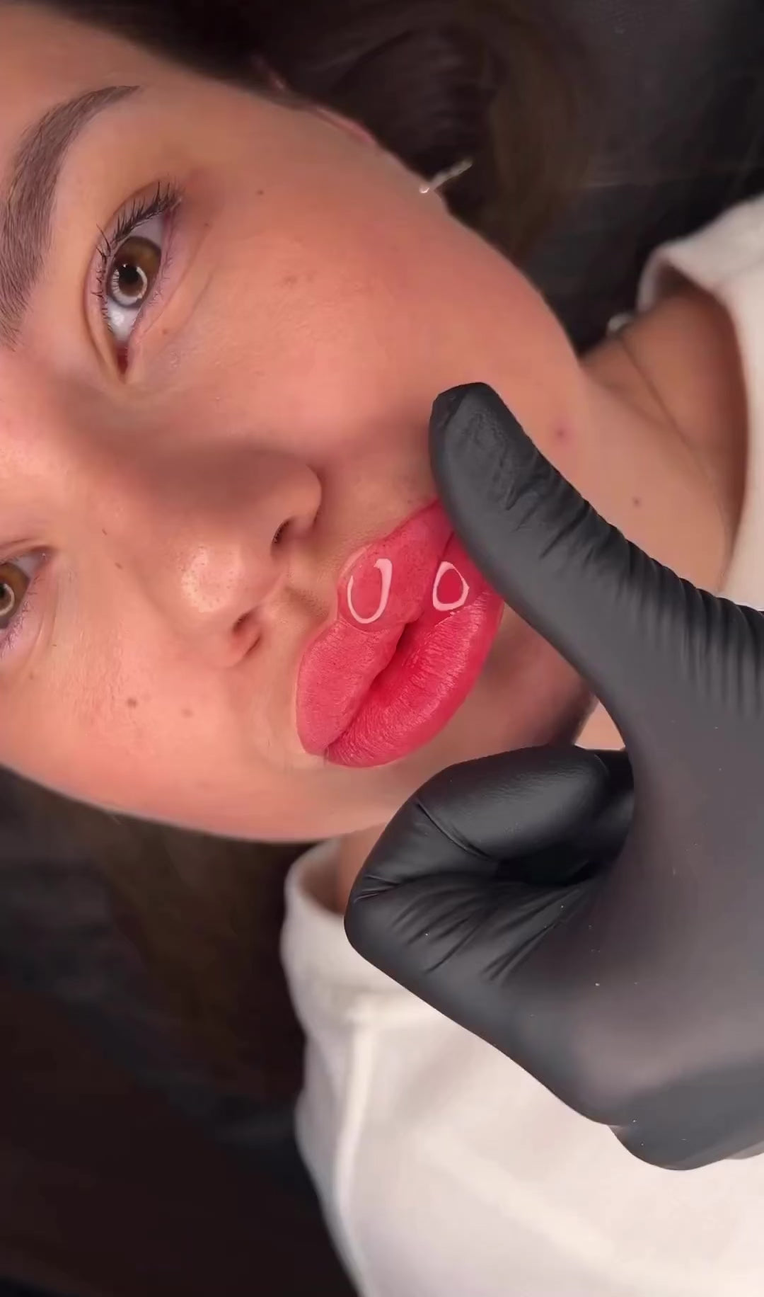 Lips filler
